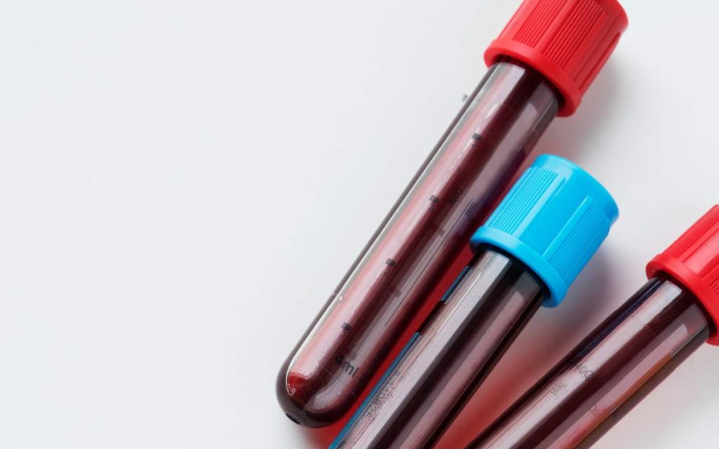 130 новых случаев ВИЧ-инфекции зарегистрировано за четыре месяца в Астане